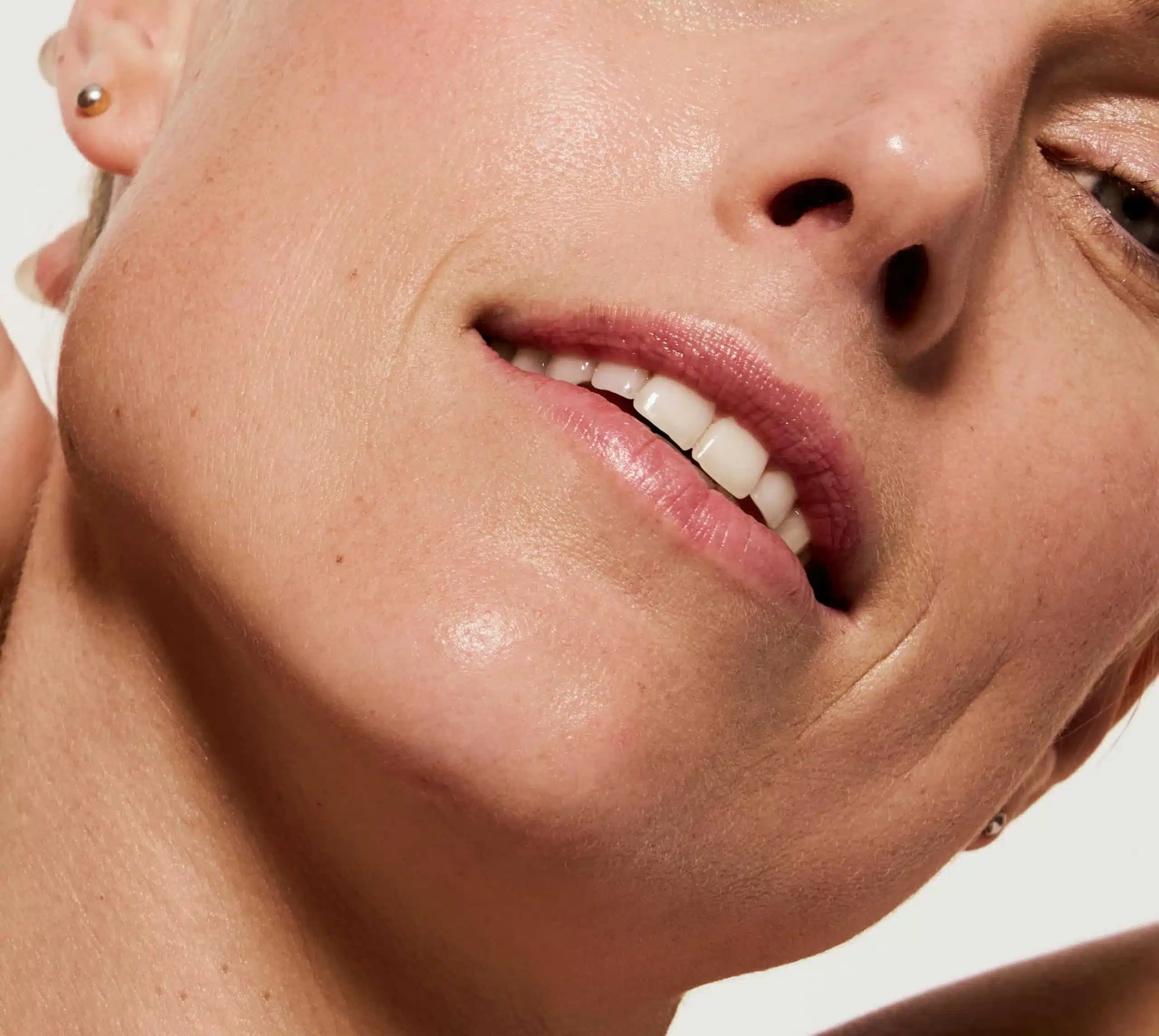 CO2-Laser Hals, Dekolleté & Handrücken Behandlung Hannover