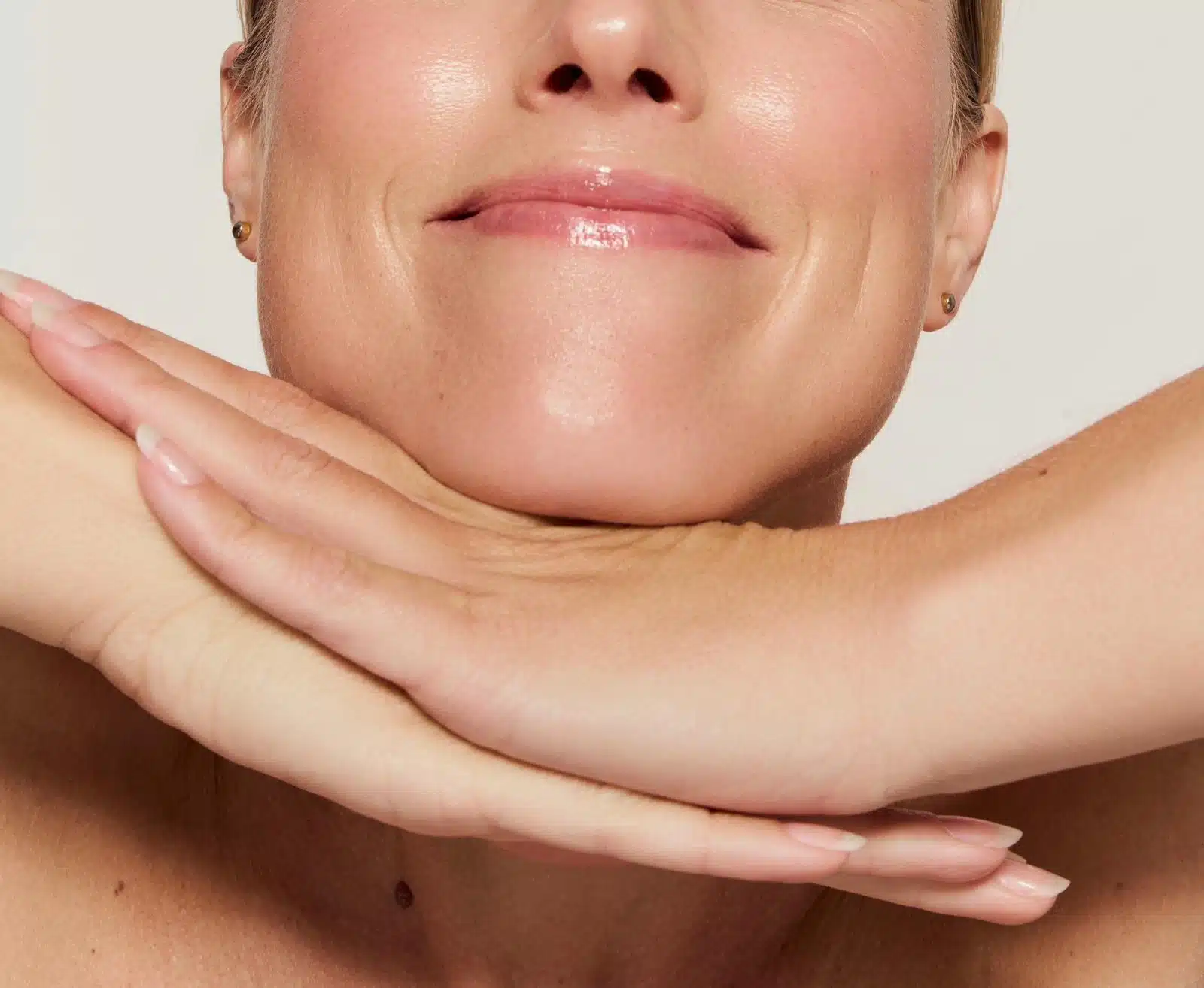 Erdbeerkinn Behandlung