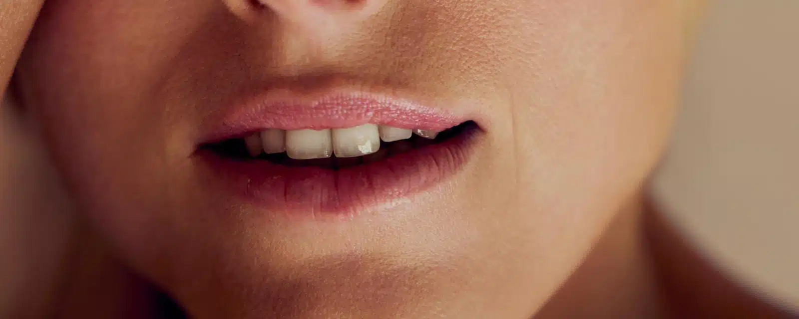 Hängende Mundwinkel Behandlung