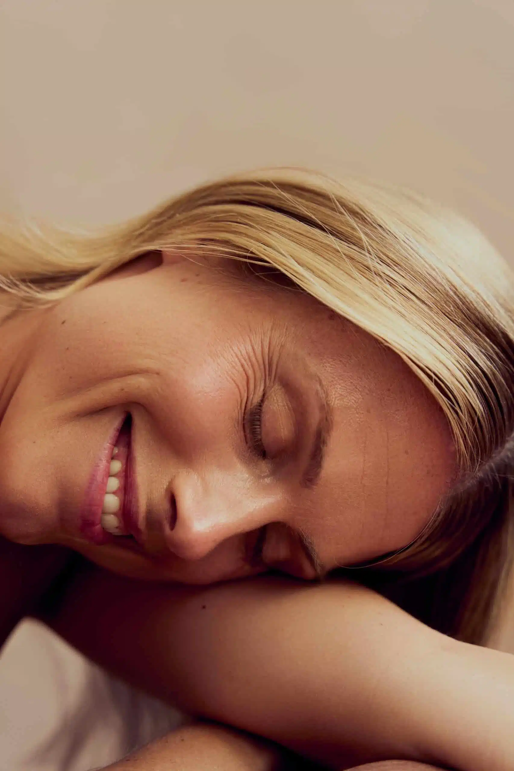 Krähenfüsse behandeln