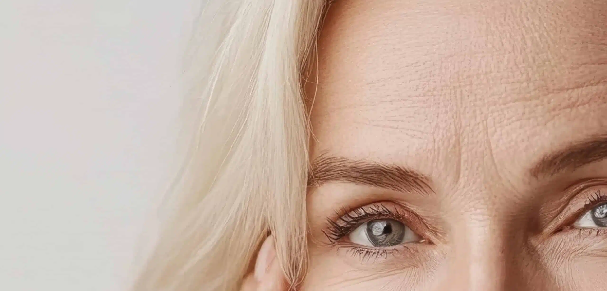 Morpheus8 für die Stirn