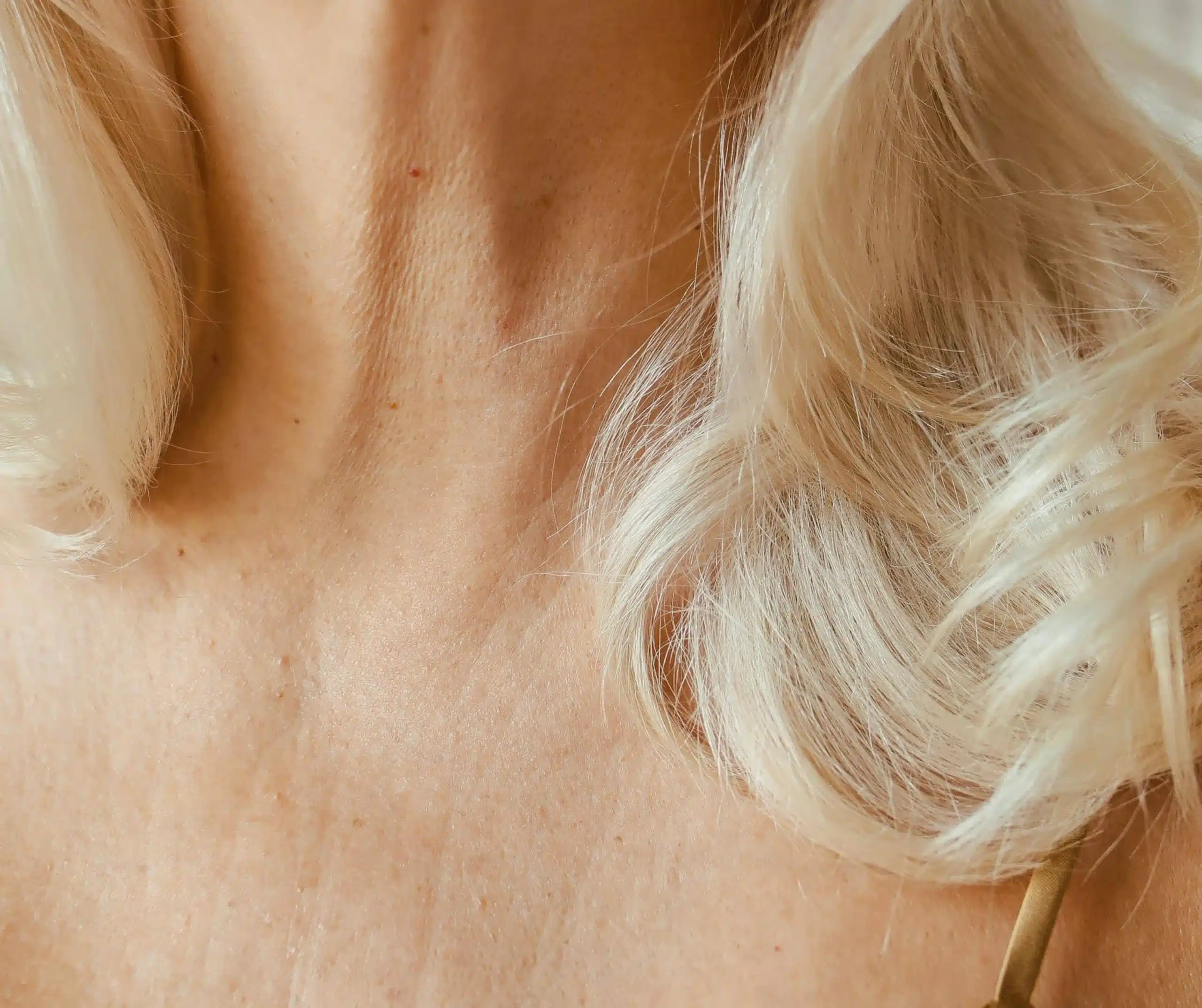 Morpheus8 für Hals und Dekolleté