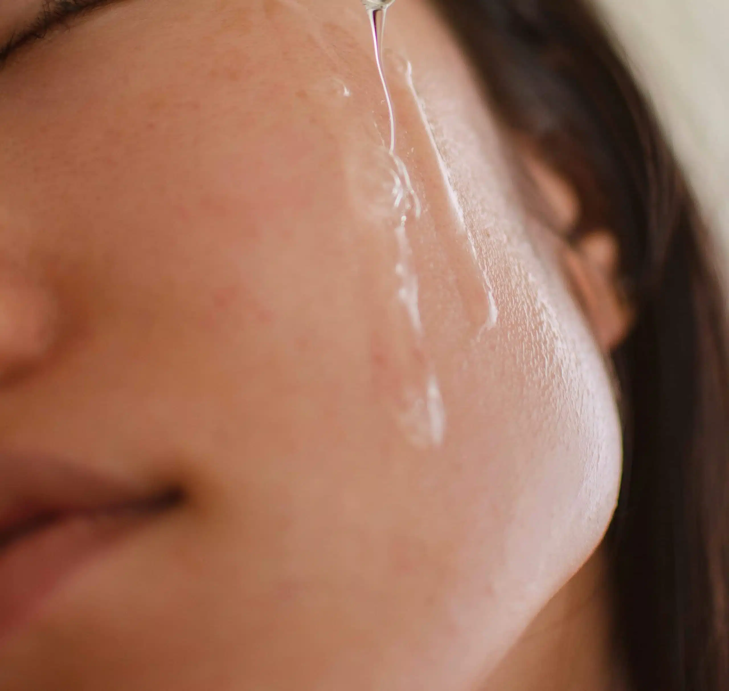 Morpheus8 Komplettbehandlung Hannover