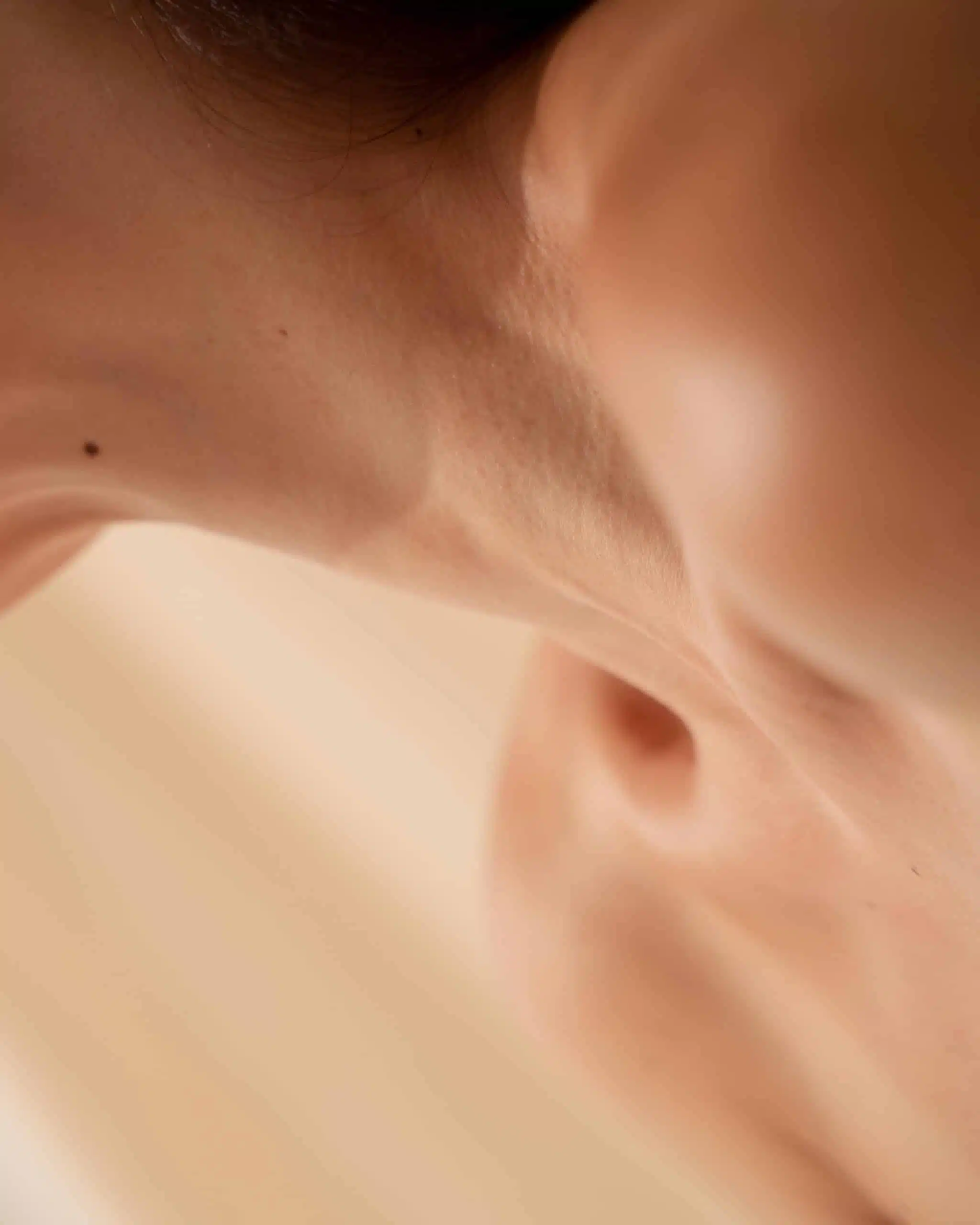 NCTF Behandlung Hannover