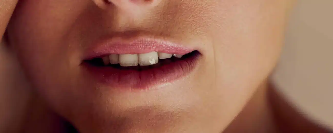 Säurepeeling Hannover